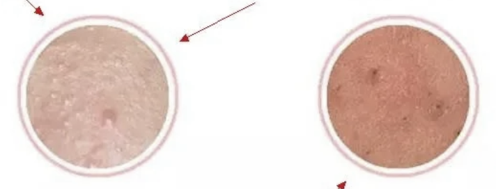 Nad+ people skin | Shaanxi BLOOM Tech Co., Ltd Nad+ people skin | Shaanxi BLOOM Tech Co., Ltd